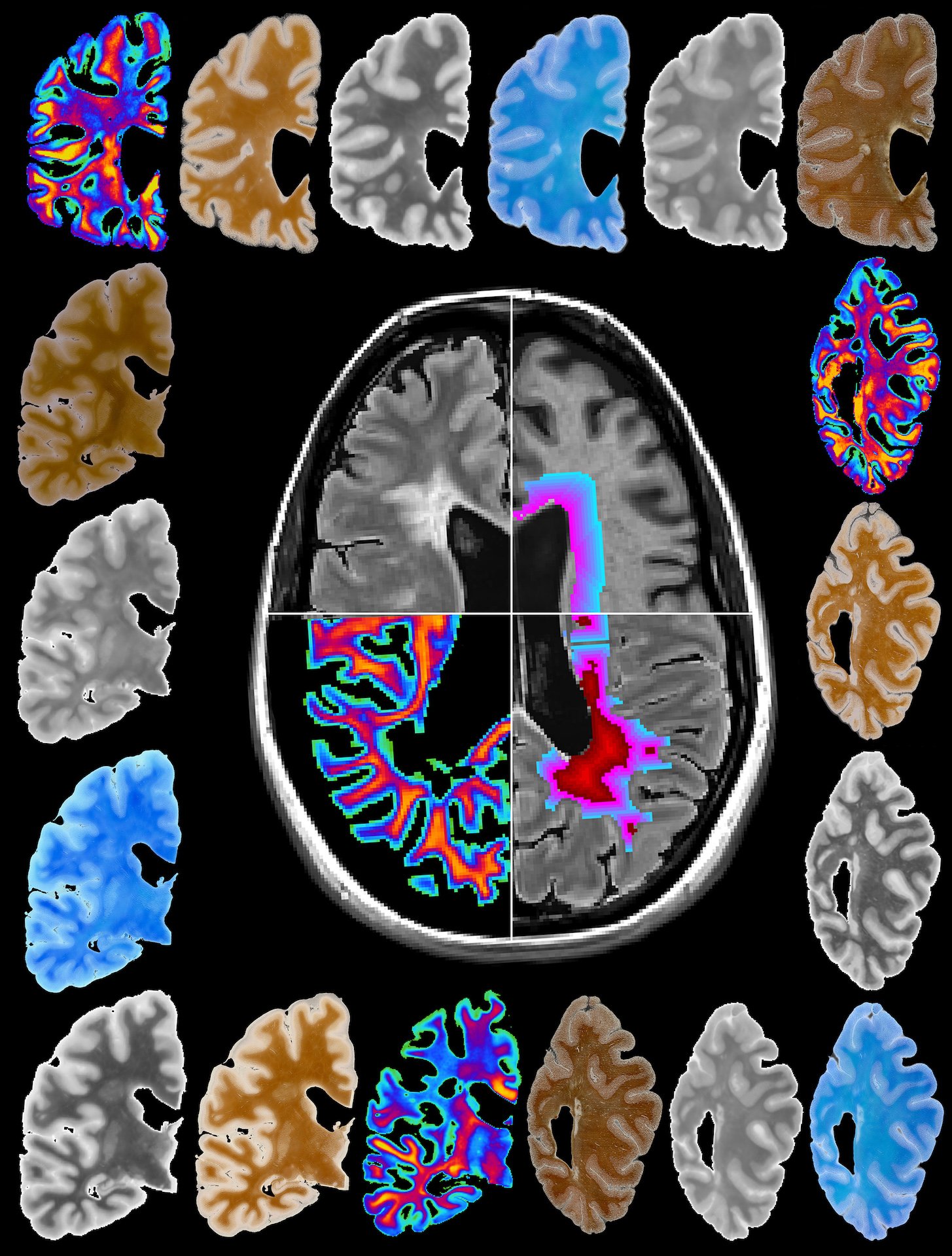 Glass Brain Project, visualizzazione dell’attività cerebrale in 3D, Adam Gazzaley, Neuroscape Lab Courtesy UCSF Weill Institute for Neurosciences, University of California San Francisco, San Francisco